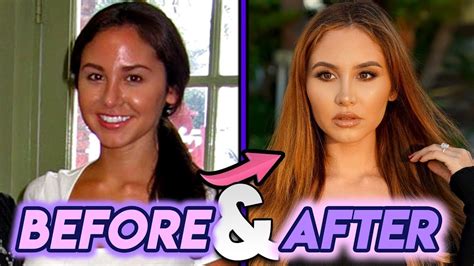 catherine paiz nose job|Catherine McBroom Reveals Her Plastic Surgery。